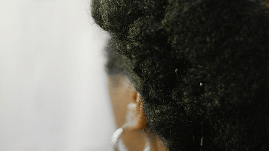 Dandruff vs. Dry Scalp - For Black Woman’s Hair